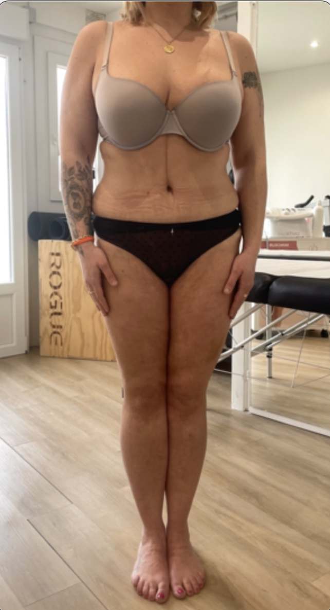 APRES