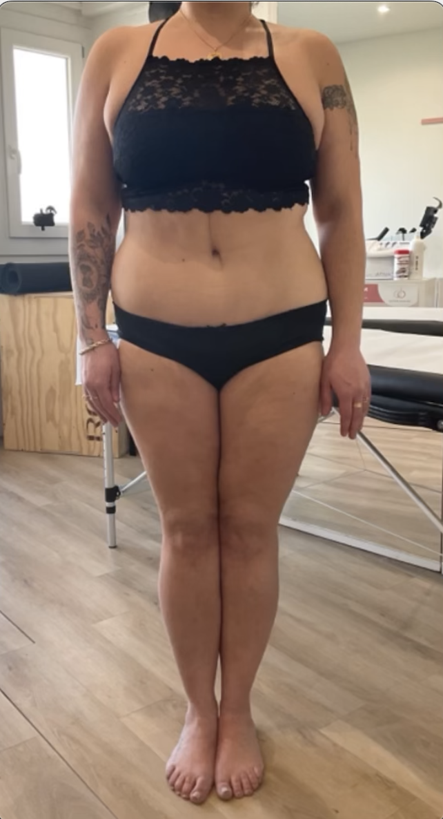 AVANT CAVITATION