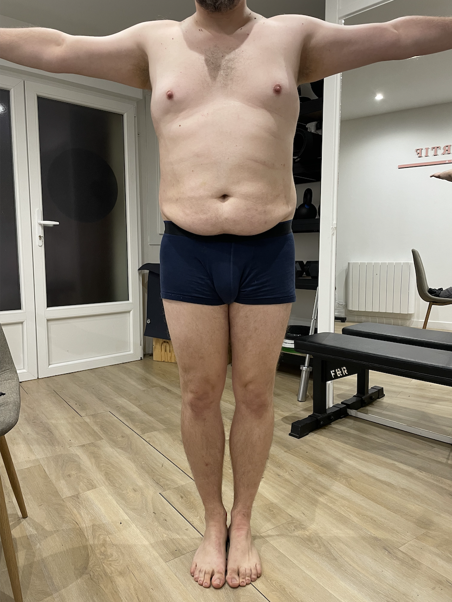 AVANT CAVITATION
